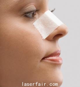 激光美白柔嫩肌肤的方法是什么